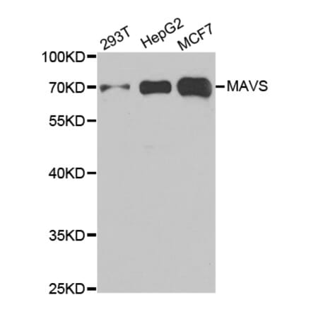 Western blot - MAVS Antibody from Signalway Antibody (33026) - Antibodies.com