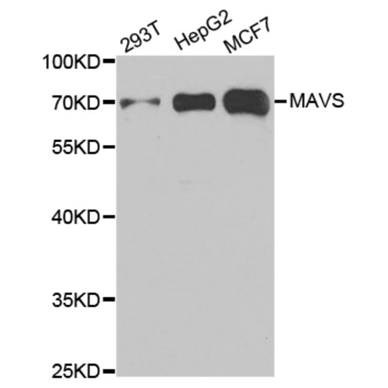 Western blot - MAVS Antibody from Signalway Antibody (33026) - Antibodies.com