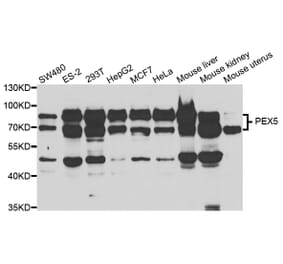 Western blot - PEX5 Antibody from Signalway Antibody (33042) - Antibodies.com