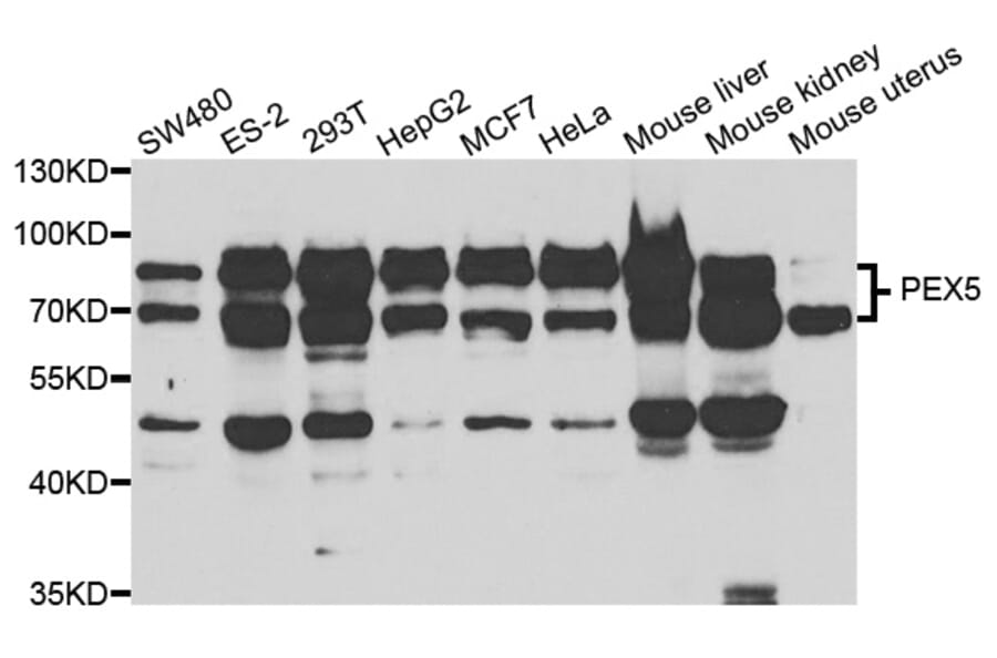 Western blot - PEX5 Antibody from Signalway Antibody (33042) - Antibodies.com