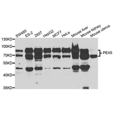 Western blot - PEX5 Antibody from Signalway Antibody (33042) - Antibodies.com