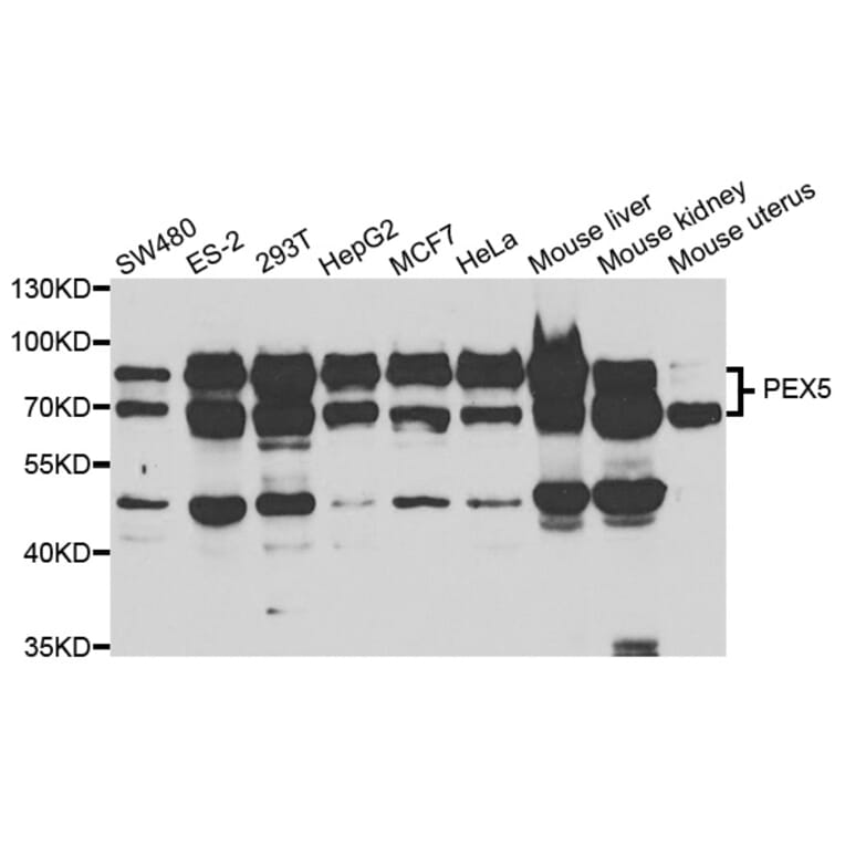 Western blot - PEX5 Antibody from Signalway Antibody (33042) - Antibodies.com