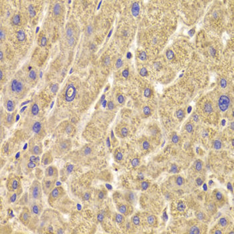 Immunohistochemistry - PEX5 Antibody from Signalway Antibody (33042) - Antibodies.com
