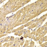 Immunohistochemistry - PEX5 Antibody from Signalway Antibody (33042) - Antibodies.com