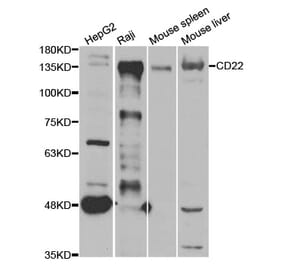 Western blot - CD22 Antibody from Signalway Antibody (33045) - Antibodies.com