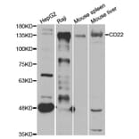 Western blot - CD22 Antibody from Signalway Antibody (33045) - Antibodies.com