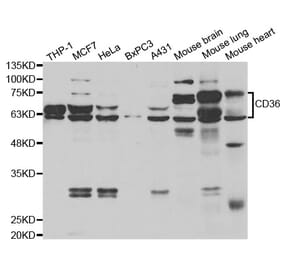 Western blot - CD36 Antibody from Signalway Antibody (33046) - Antibodies.com