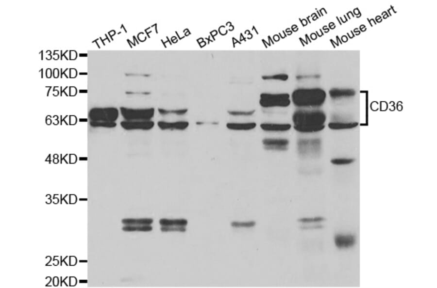 Western blot - CD36 Antibody from Signalway Antibody (33046) - Antibodies.com