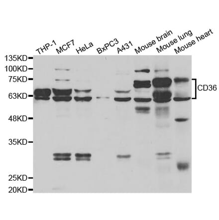 Western blot - CD36 Antibody from Signalway Antibody (33046) - Antibodies.com