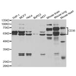 Western blot - CD36 Antibody from Signalway Antibody (33046) - Antibodies.com