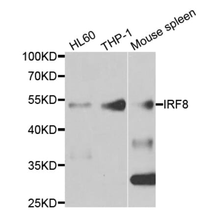Western blot - IRF8 Antibody from Signalway Antibody (33050) - Antibodies.com