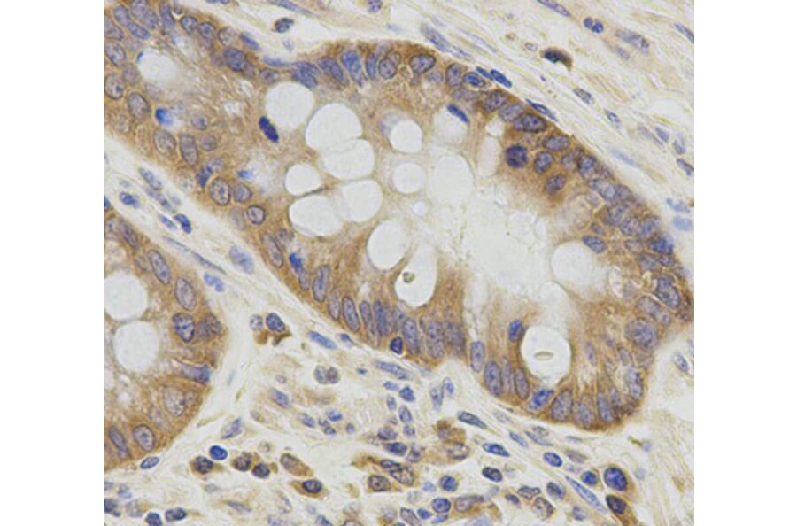 Immunohistochemistry - ATG3 Antibody from Signalway Antibody (33057) - Antibodies.com