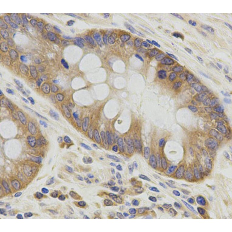 Immunohistochemistry - ATG3 Antibody from Signalway Antibody (33057) - Antibodies.com