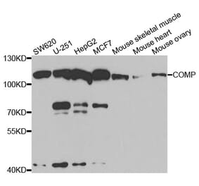 Western blot - COMP Antibody from Signalway Antibody (33060) - Antibodies.com