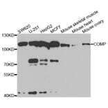 Western blot - COMP Antibody from Signalway Antibody (33060) - Antibodies.com