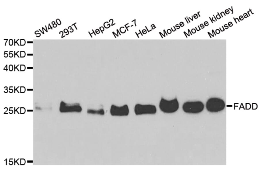 Western blot - FADD Antibody from Signalway Antibody (33065) - Antibodies.com