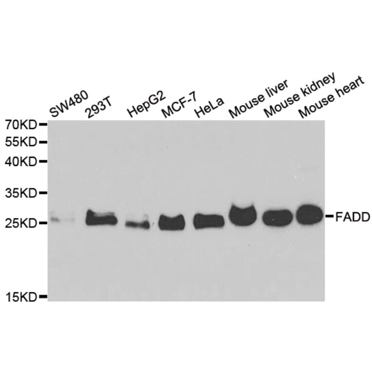 Western blot - FADD Antibody from Signalway Antibody (33065) - Antibodies.com