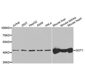 Western blot - GOT1 Antibody from Signalway Antibody (33068) - Antibodies.com