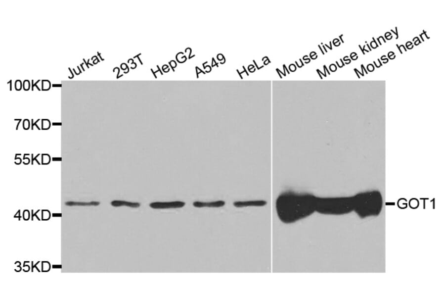 Western blot - GOT1 Antibody from Signalway Antibody (33068) - Antibodies.com