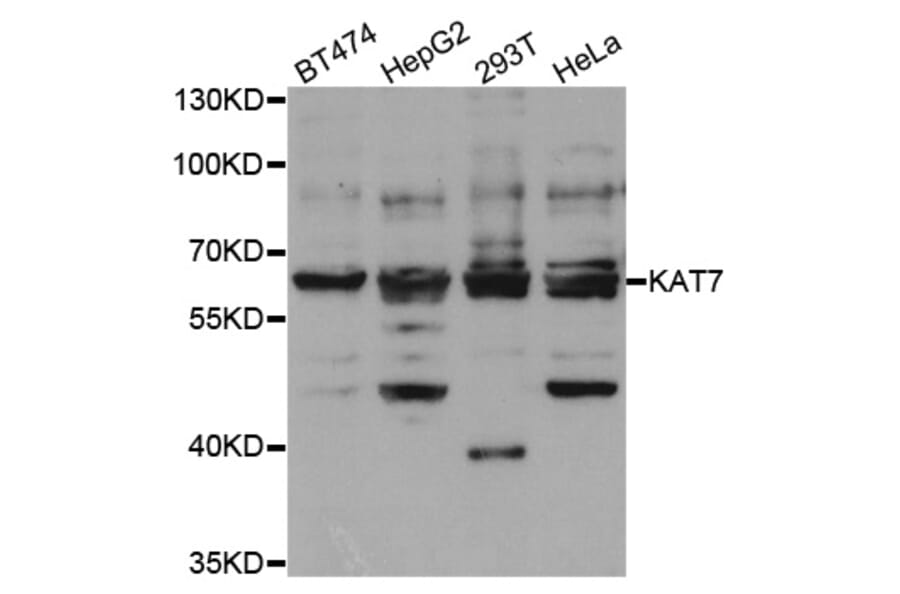 Western blot - KAT7 Antibody from Signalway Antibody (33069) - Antibodies.com