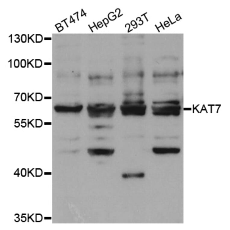 Western blot - KAT7 Antibody from Signalway Antibody (33069) - Antibodies.com