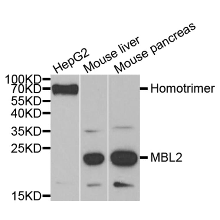 Western blot - MBL2 Antibody from Signalway Antibody (33070) - Antibodies.com