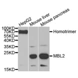 Western blot - MBL2 Antibody from Signalway Antibody (33070) - Antibodies.com