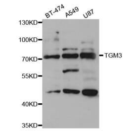 Western blot - TGM3 Antibody from Signalway Antibody (33094) - Antibodies.com