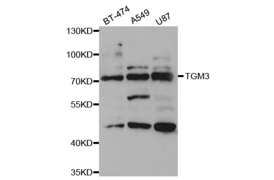 Western blot - TGM3 Antibody from Signalway Antibody (33094) - Antibodies.com