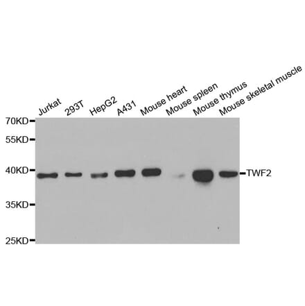 Western blot - TWF2 Antibody from Signalway Antibody (33097) - Antibodies.com