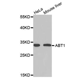Western blot - ABT1 Antibody from Signalway Antibody (33104) - Antibodies.com