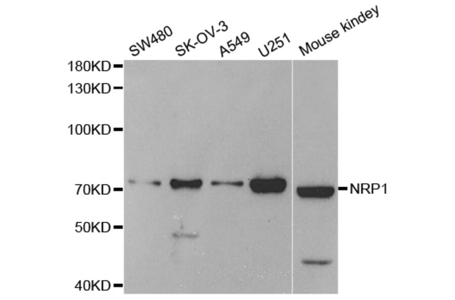 Western blot - NRP1 Antibody from Signalway Antibody (33113) - Antibodies.com