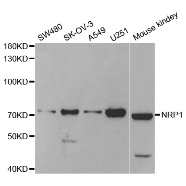 Western blot - NRP1 Antibody from Signalway Antibody (33113) - Antibodies.com