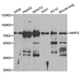 Western blot - MMP2 Antibody from Signalway Antibody (33114) - Antibodies.com