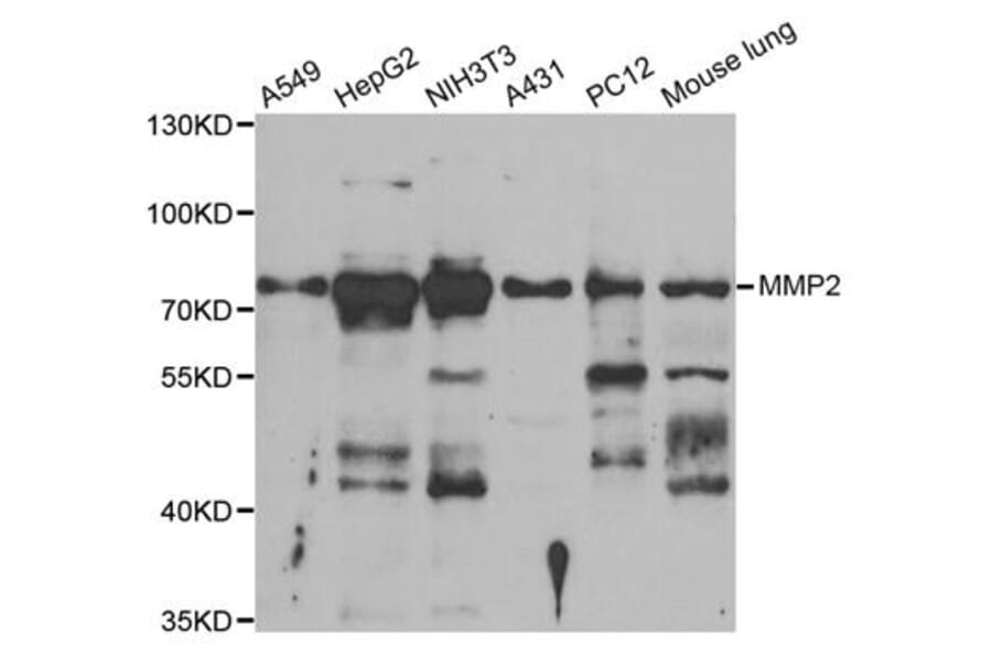 Western blot - MMP2 Antibody from Signalway Antibody (33114) - Antibodies.com