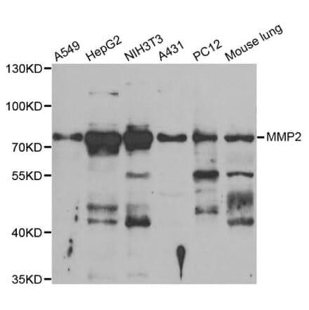 Western blot - MMP2 Antibody from Signalway Antibody (33114) - Antibodies.com