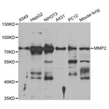 Western blot - MMP2 Antibody from Signalway Antibody (33114) - Antibodies.com