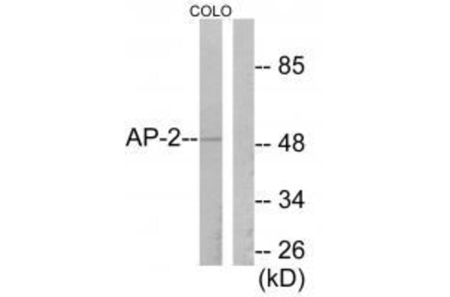 Western blot - AP-2 Antibody from Signalway Antibody (33323) - Antibodies.com