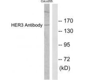 Western blot - HER3 Antibody from Signalway Antibody (33337) - Antibodies.com