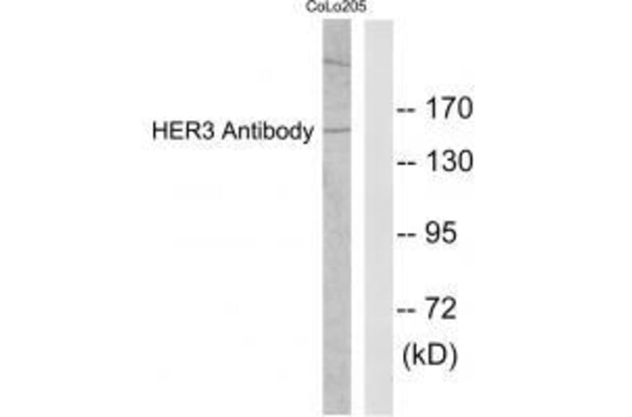 Western blot - HER3 Antibody from Signalway Antibody (33337) - Antibodies.com
