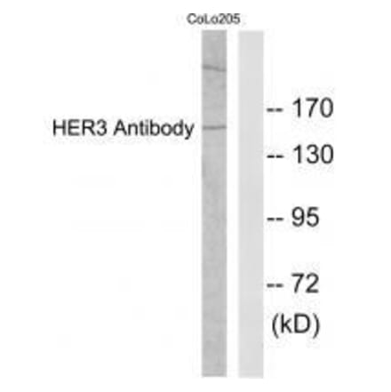 Western blot - HER3 Antibody from Signalway Antibody (33337) - Antibodies.com
