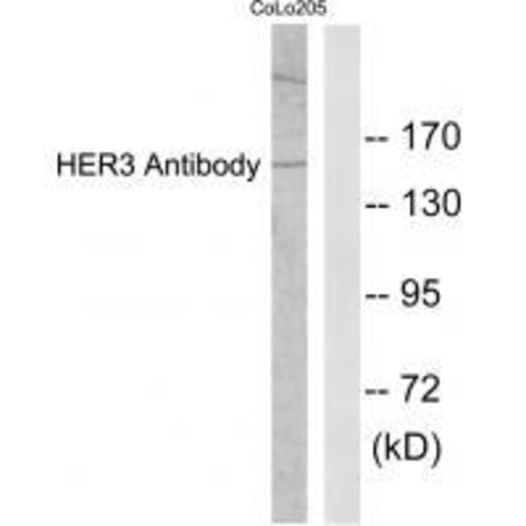 Western blot - HER3 Antibody from Signalway Antibody (33337) - Antibodies.com