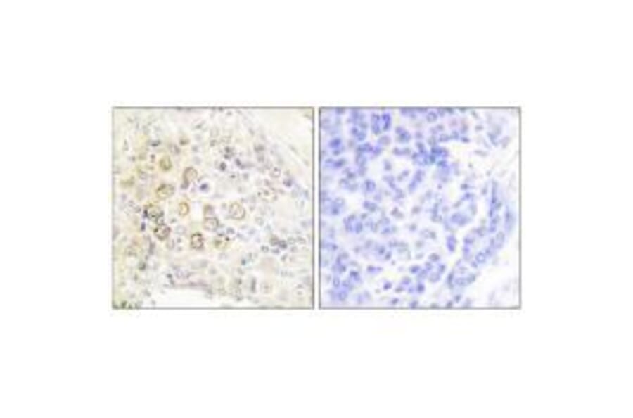 Immunohistochemistry - HER3 Antibody from Signalway Antibody (33337) - Antibodies.com