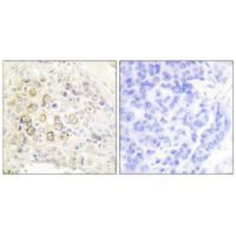 Immunohistochemistry - HER3 Antibody from Signalway Antibody (33337) - Antibodies.com