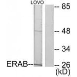 Western blot - ERAB Antibody from Signalway Antibody (33365) - Antibodies.com