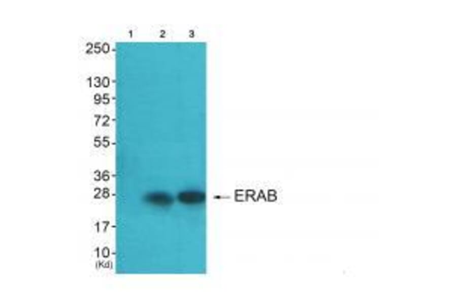 Western blot - ERAB Antibody from Signalway Antibody (33365) - Antibodies.com
