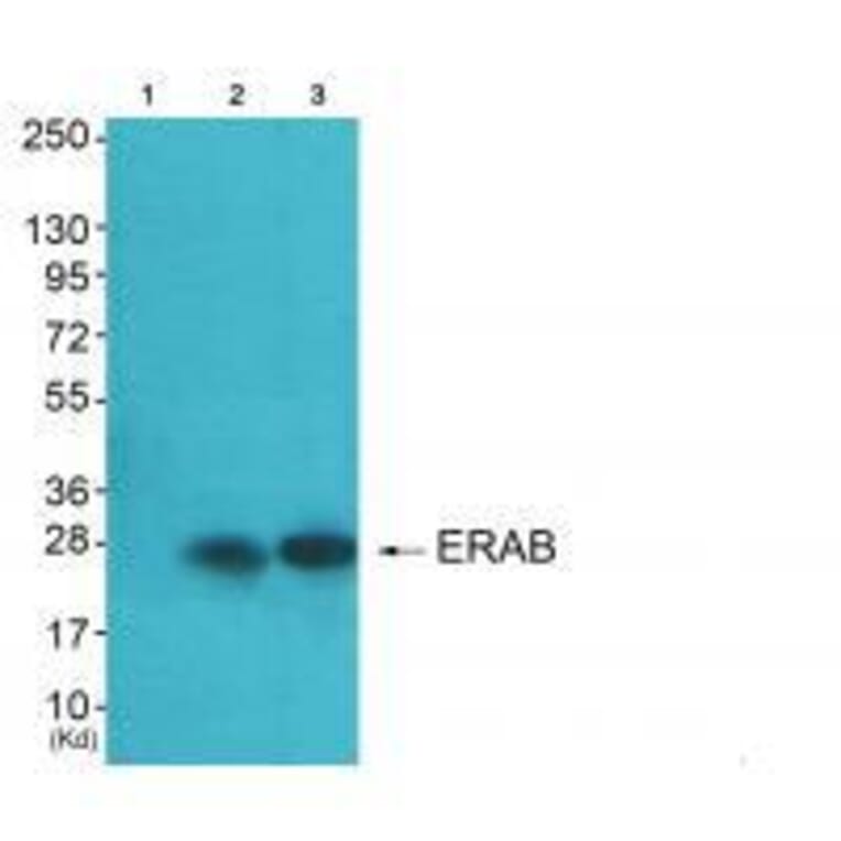 Western blot - ERAB Antibody from Signalway Antibody (33365) - Antibodies.com