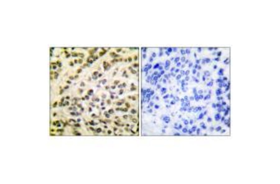 Immunohistochemistry - FLI1 Antibody from Signalway Antibody (33376) - Antibodies.com