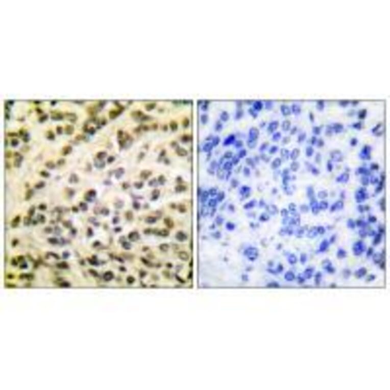 Immunohistochemistry - FLI1 Antibody from Signalway Antibody (33376) - Antibodies.com