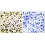 Immunohistochemistry - FLI1 Antibody from Signalway Antibody (33376) - Antibodies.com